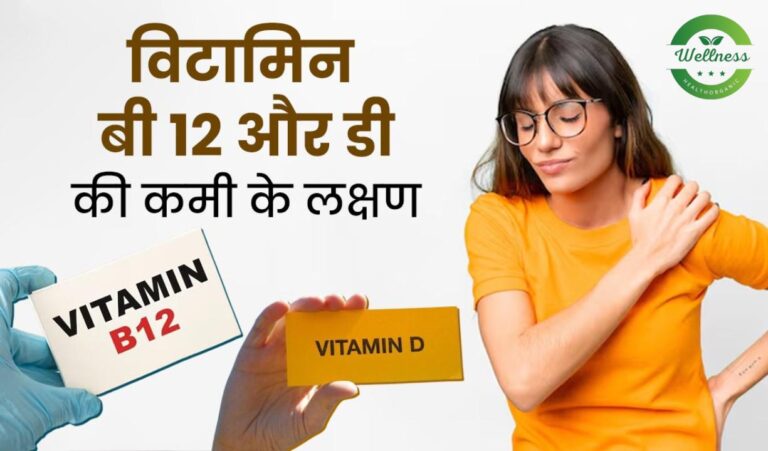 Vitamin B12 Deficiency